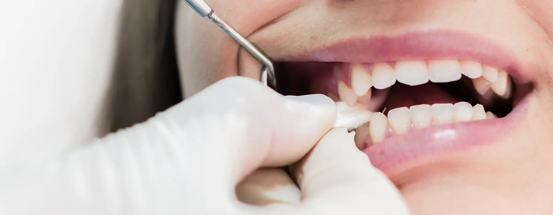 How Long Should You Keep Gauze in After a Tooth Extraction?