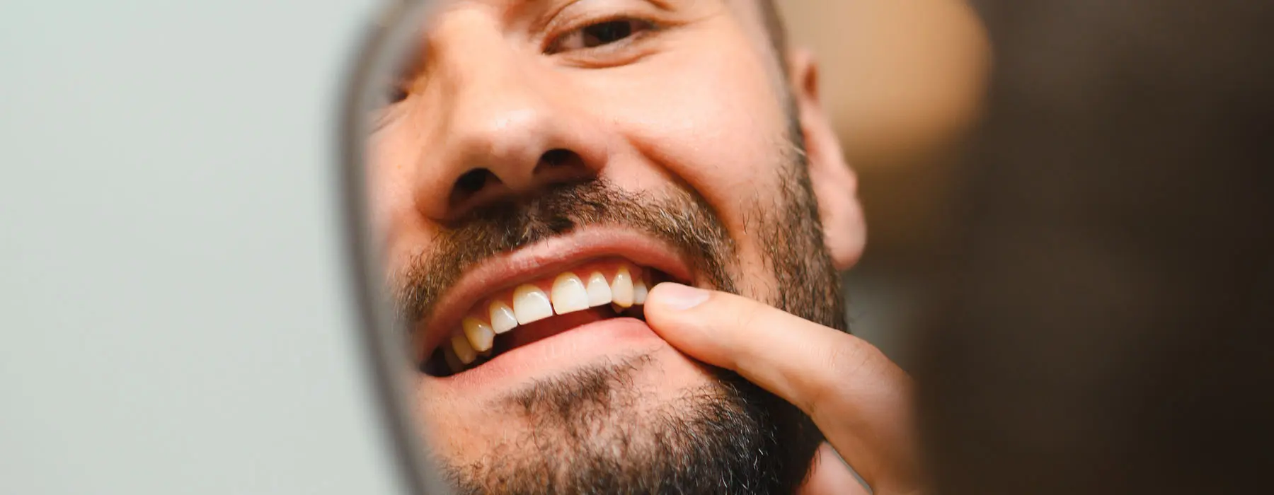 Can Your Body Reject Dental Implants?