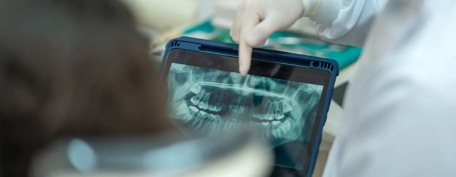 When Is Jaw Surgery Necessary for Bite Problems?
