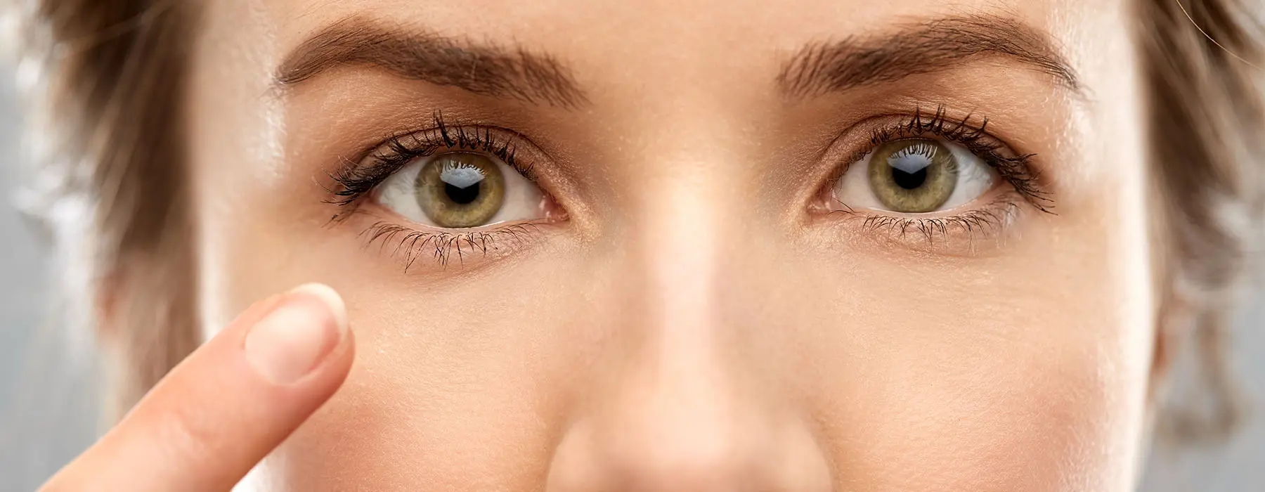 Ultherapy for a Non-Surgical Brow Lift