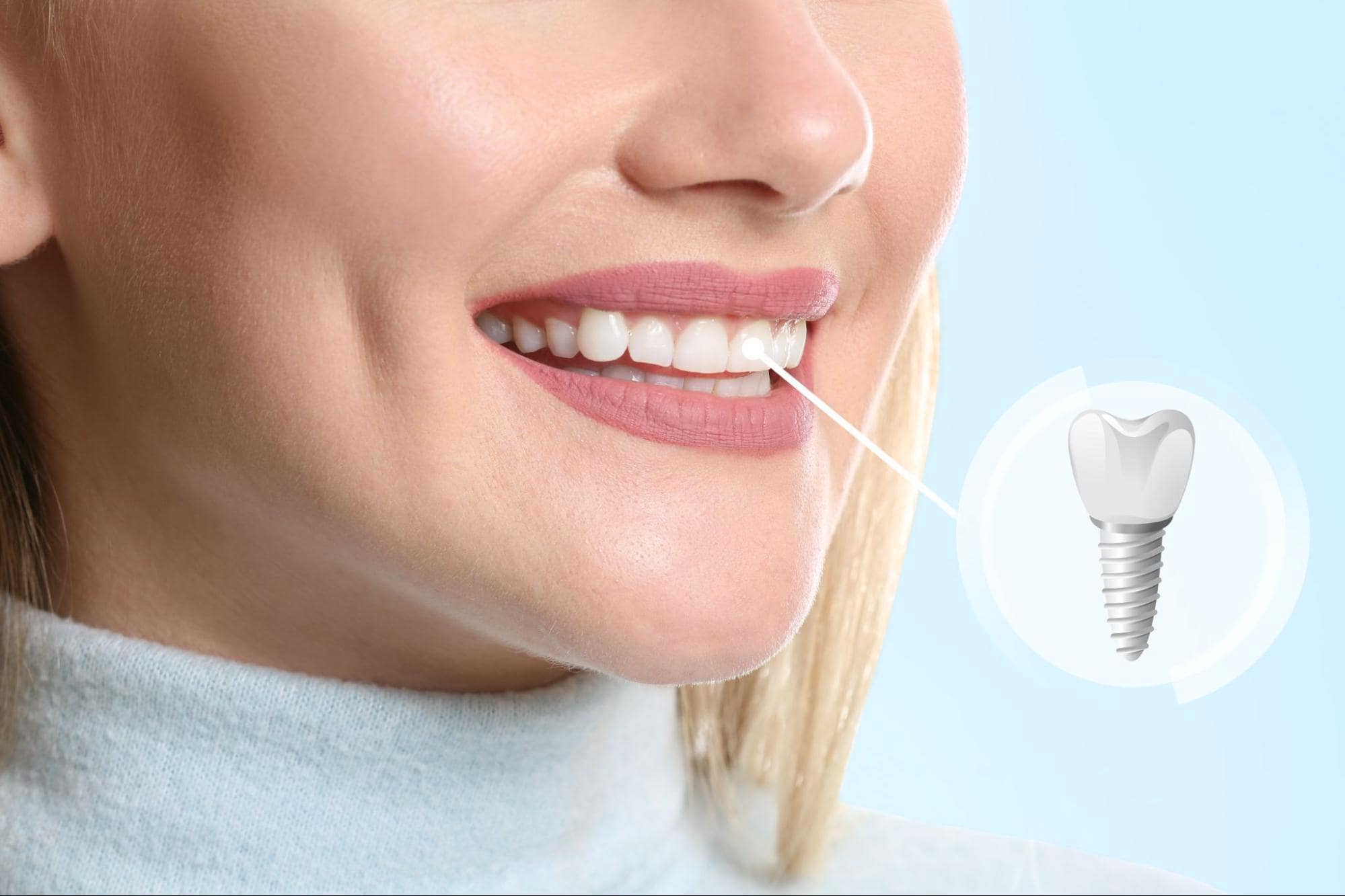 Dental Implants: The Long-term Solution for Your Smile