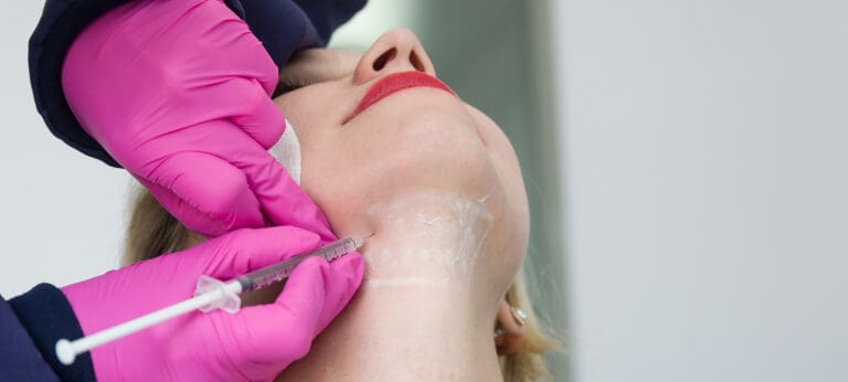 Kybella Chin Contouring in Issaquah, WA