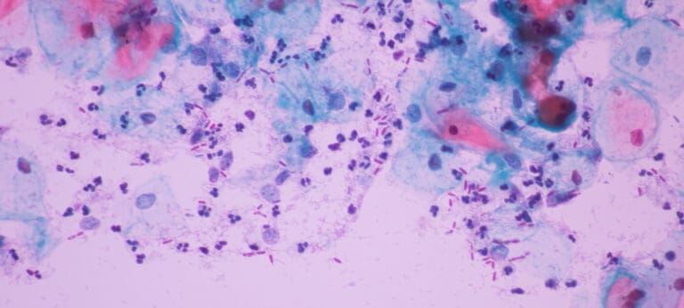 Oral Pathology in Issaquah, WA