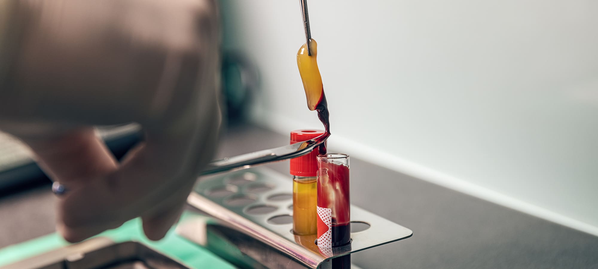 Platelet Rich Fibrin (PRF)