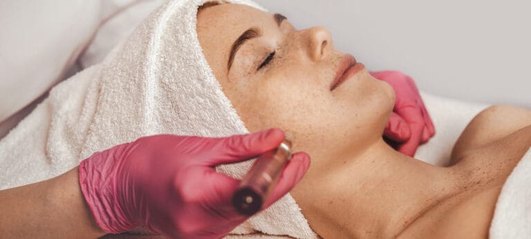 SkinPen® Microneedling in Issaquah, WA