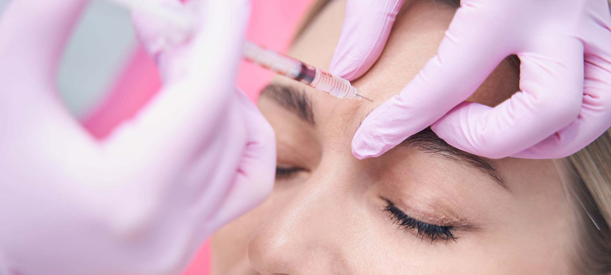 Juvederm® in Issaquah, WA