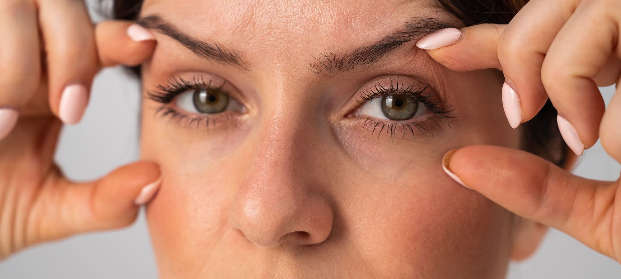 Blepharoplasty in Issaquah: Restore Bright, Youthful Eyes