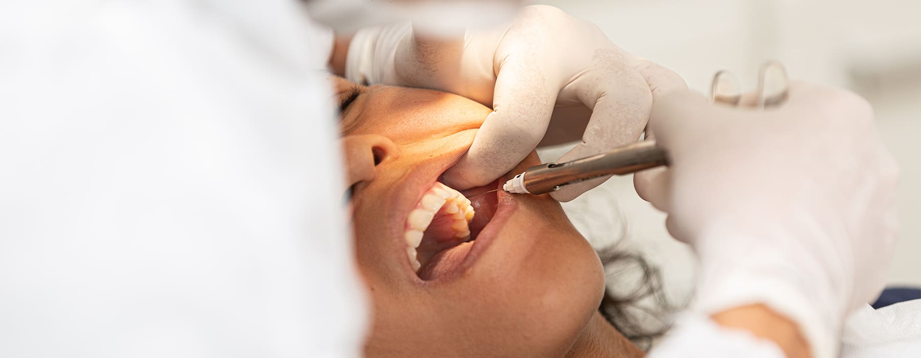 Same-Day Molar Implants Without The Wait